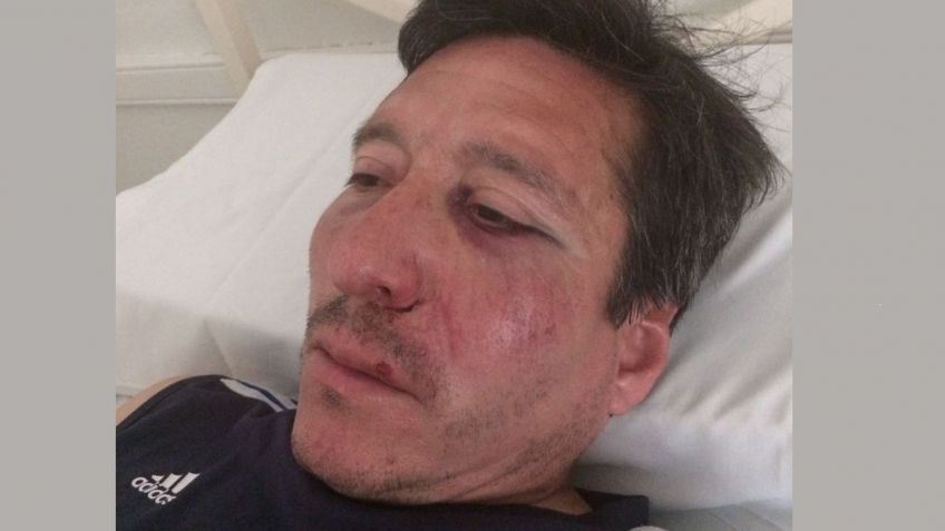 Salvaje agresión en el Fútbol Agrario