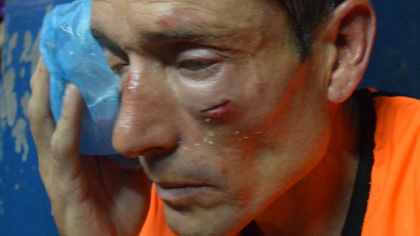 Otra brutal agresión a un árbitro, ahora en Ayacucho