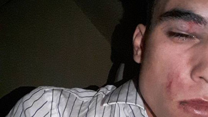 Grave denuncia contra seguridad de un boliche por golpiza
