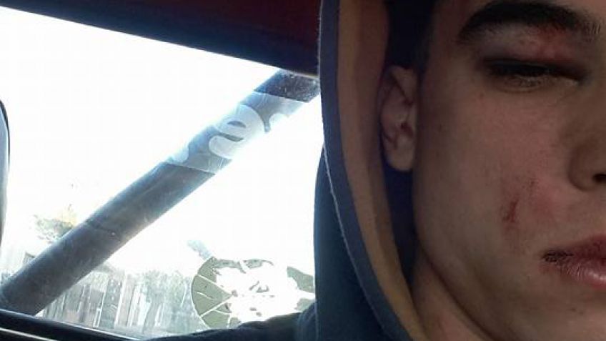 Grave denuncia contra seguridad de un boliche por golpiza