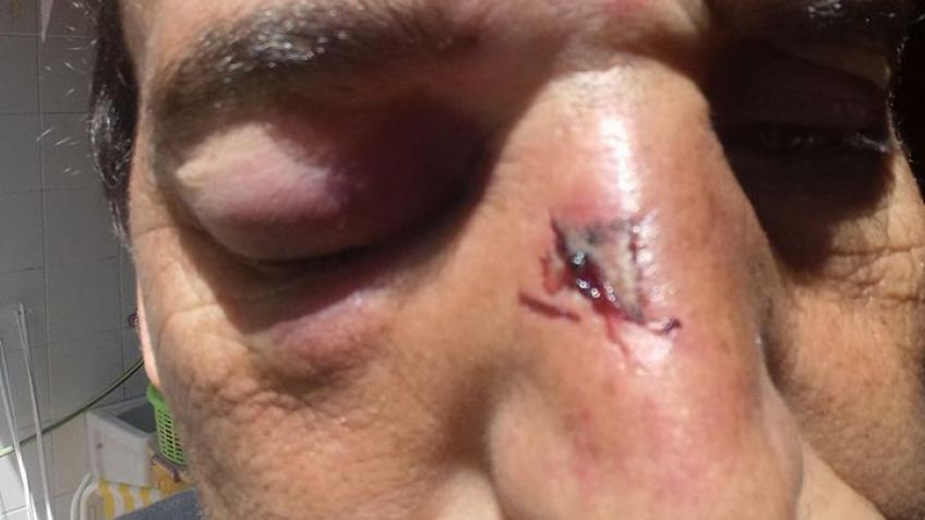 Otra agresión a un árbitro de fútbol