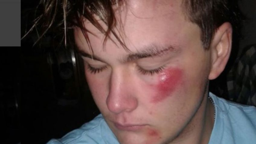 Un joven fue golpeado a la salida del boliche por ser gay