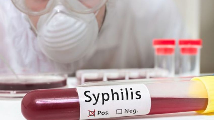 Preocupa el aumento de casos de sífilis en Tandil y la provincia
