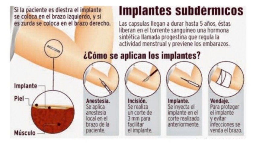 No seamos forros