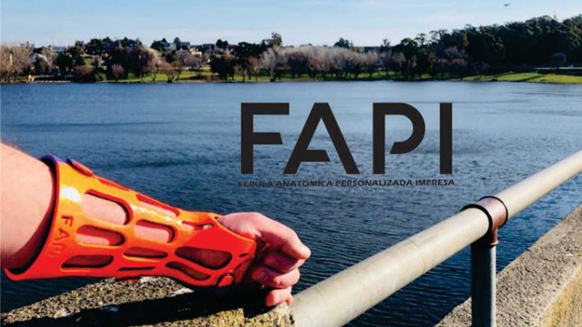 Emprendimientos tandilenses: férulas a medida del paciente