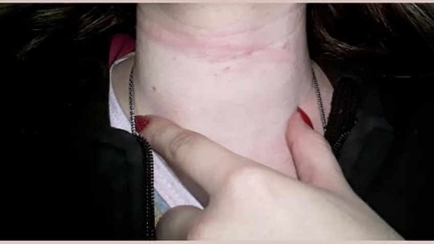 Joven denunció ser abusada en la vía pública 
