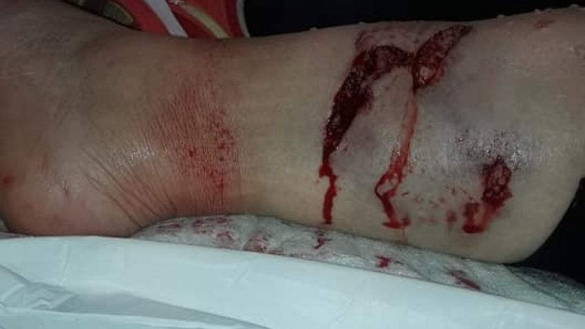 Una mujer fue mordida por un perro en la plaza del centro