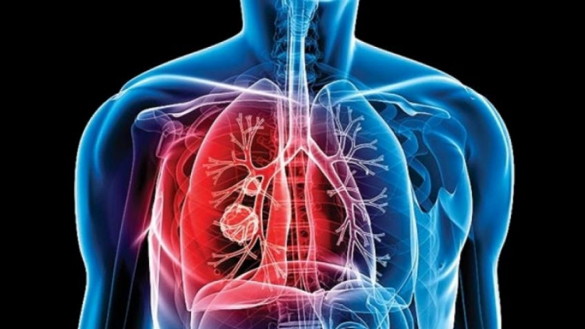 La OMS instó a "acabar con todos los casos" de tuberculosis