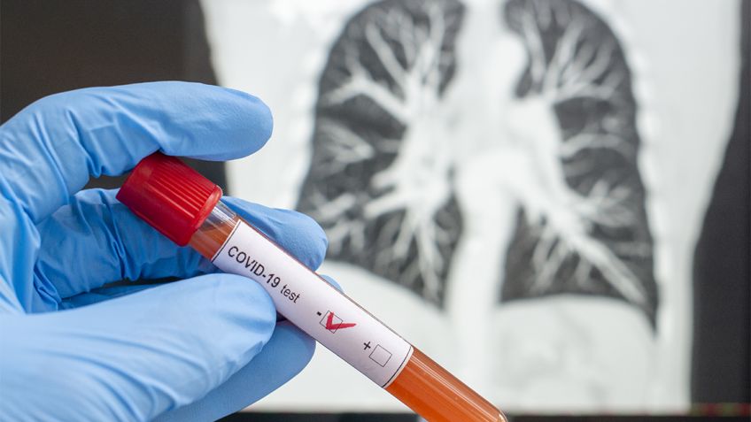 En unos diez días comenzarían a realizar los estudios de Coronavirus en Tandil