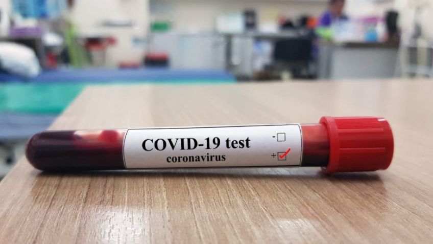 Cuarto caso de Covid-19: Intentarán determinar si su novia tuvo el virus anteriormente
