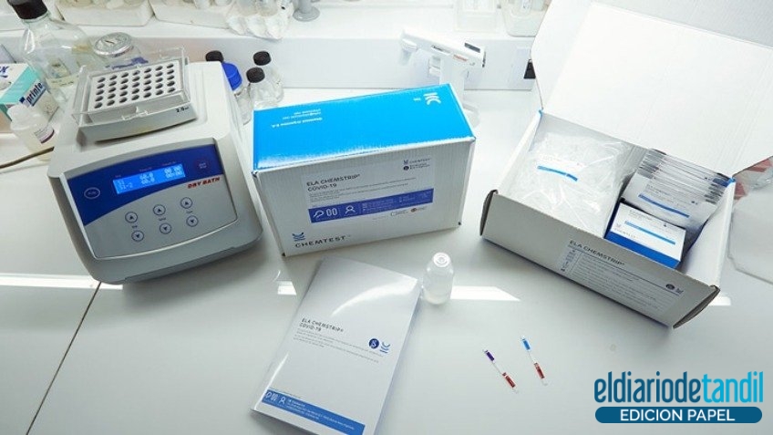 Aprueban el uso de un nuevo test molecular de COVID-19, sensible, específico, rápido y económico