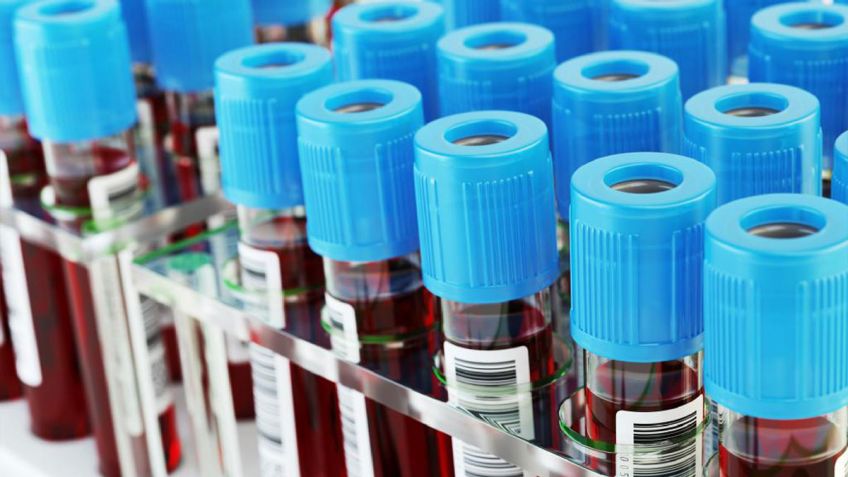 Esperan que la serología pueda dar más pistas sobre el inicio del octavo caso