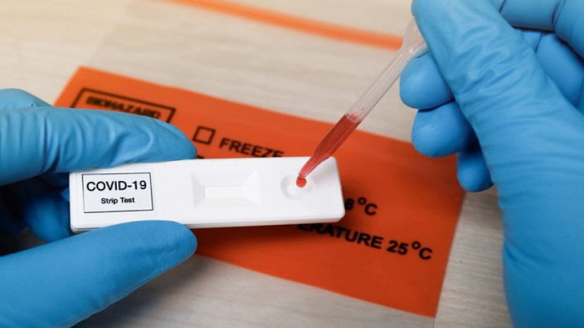 El Municipio comenzará a utilizar los kits de testeo rápido