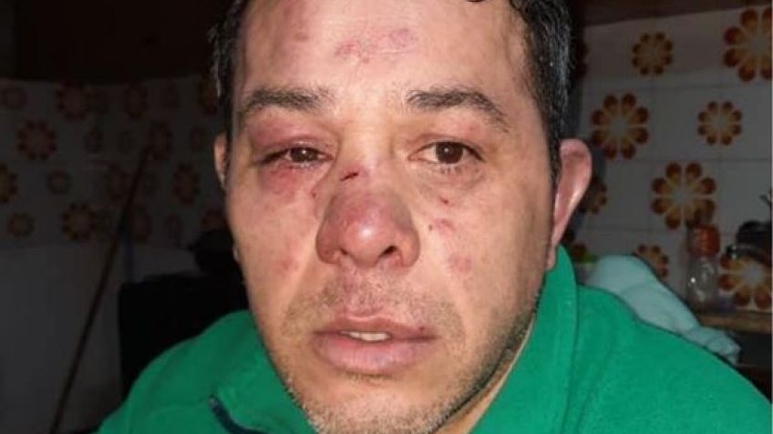 Mauricio Luján, tras el ataque: "Se bajaron a matarme"