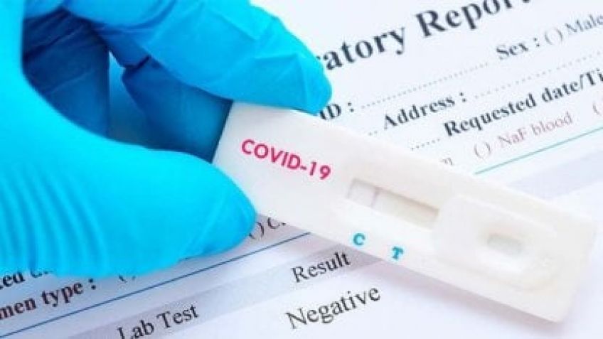Se conocieron los mecanismos establecidos para la notificación del autotest de coronavirus