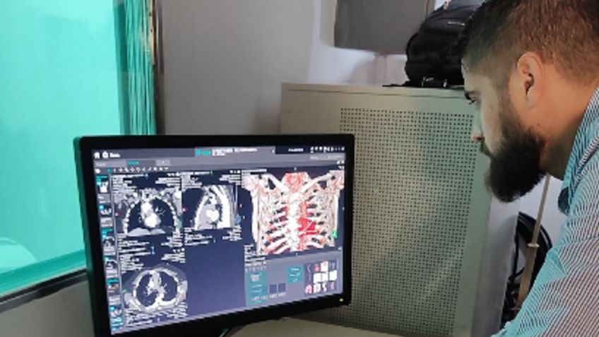 El Sistema Integrado de Salud realiza estudios cardíacos avanzados en el tomógrafo