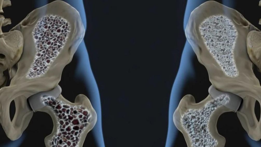 Se realizará la Jornada "Sobre prevención y tratamiento de Osteoporosis y Sarcopenia"