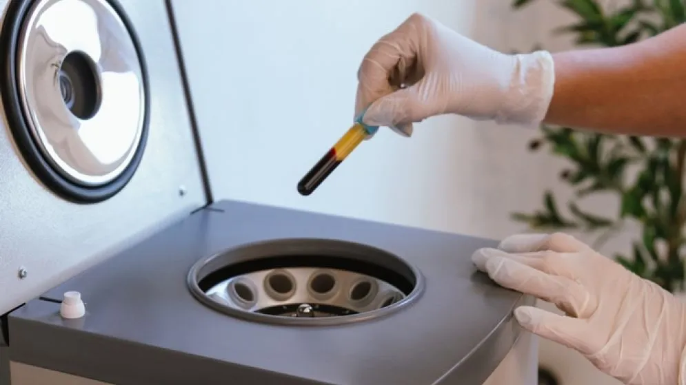 5 factores clave detrás de la caída del cabello (y cómo enfrentarlos)